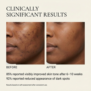 Dark Spot Correcting Serum