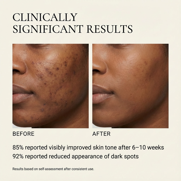 Dark Spot Correcting Serum